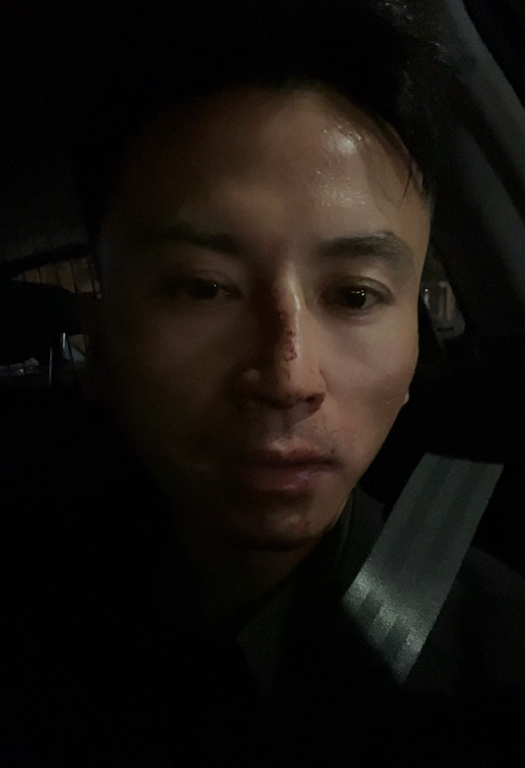 澳洲23岁华女市中心遭种族袭击，被两人殴打！“指甲断裂，脑震荡”（组图） - 17
