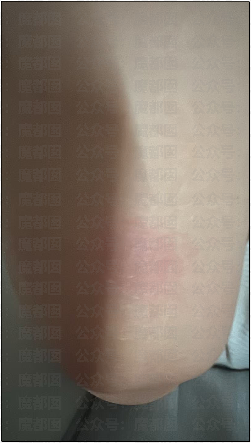 未成年少女邀两男子深夜喝酒,后报警称遭轮奸!男方赔偿1万1私了引热议(组图) - 4