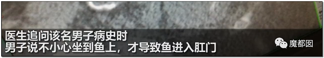 14岁男孩网购假YJ塞GM后整体滑入拿不出来!青少年X教育热议 - 46