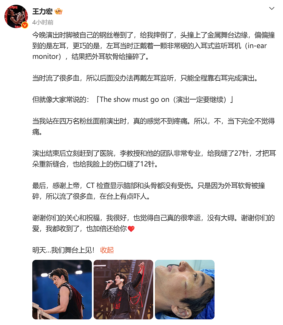 知名男星演唱会突发意外!脸被划伤、左耳磕破流血,本人凌晨发文回应(组图) - 3
