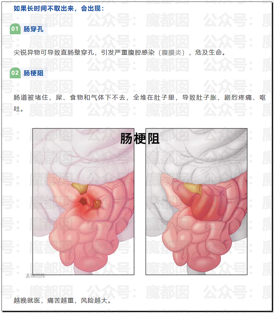 14岁男孩网购假YJ塞GM后整体滑入拿不出来!青少年X教育热议 - 30