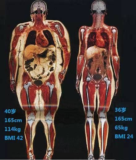 【健身】BBC解剖了一个214斤的女子，看完你会用生命去减肥！ - 4