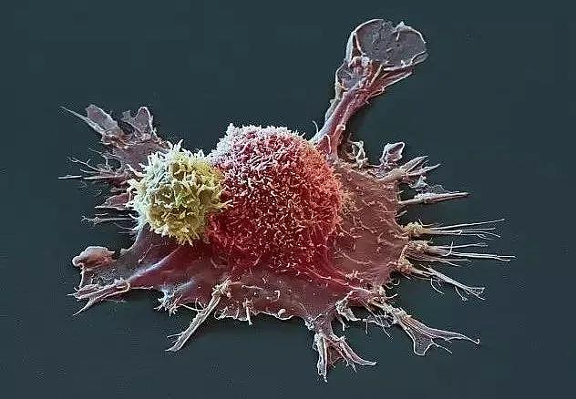 如何提高CAR-T细胞疗效及安全性，攻克实体瘤？