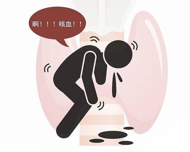 前CBA球员吉喆因肺癌去世：平时不抽烟，为何还得癌？别忽略这5点