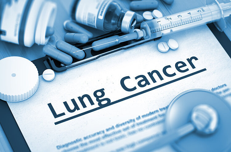 体检中心恶性肿瘤数据：肺癌是头号杀手！专家：三大症状不能拖