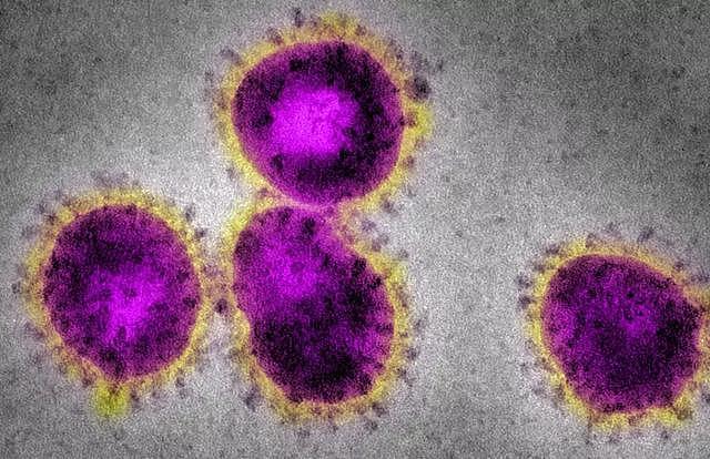 最新｜武汉不明原因肺炎与新型冠状病毒有关，民众该如何预防？