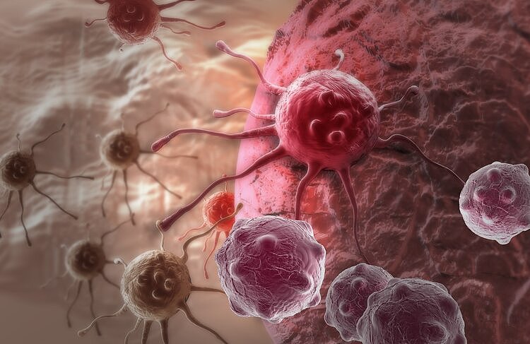 抗癌里程碑！科学家找到新癌症疗法，病灶消失，不产生副作用