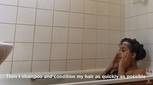 英国23岁女孩患罕见水过敏，不敢出汗流眼泪，洗澡宛如受刑