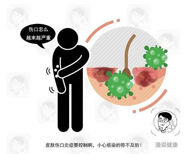 糖尿病患者，若睡前有这4个表现，医生提醒：你需要降血糖了