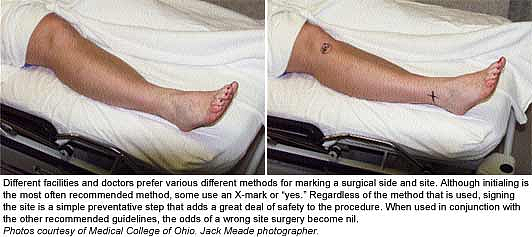 严重医疗事故！香港医生术后发现“开错刀”，误将右脚当左脚