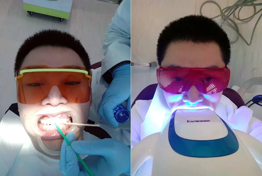 为什么大多数美白牙膏没效果？专业牙医解密7大牙齿美白方法