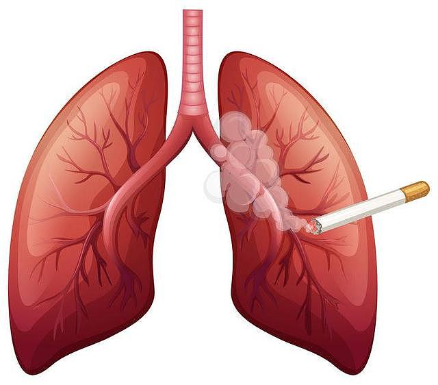 长期吸烟的人，最怕出现5种现象！若都出现，怕是与肺癌一步之遥
