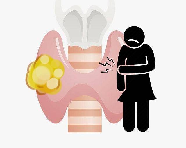 体内有癌，嗓子先知？嗓子若出现这种现象，或许是癌细胞已到来