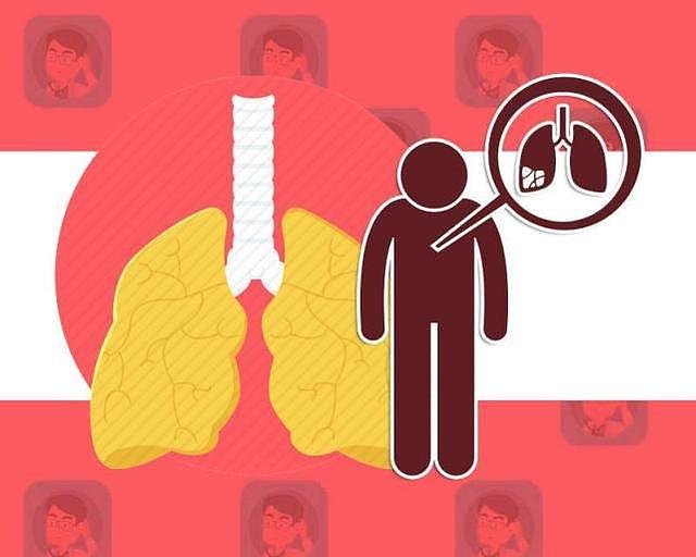 家庭主妇查出肺癌，却与抽烟喝酒无关？这个因素，很多人都难避免
