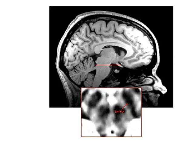 孤独感可被关闭？科学家找到相应大脑神经回路，原理与饥饿感类似