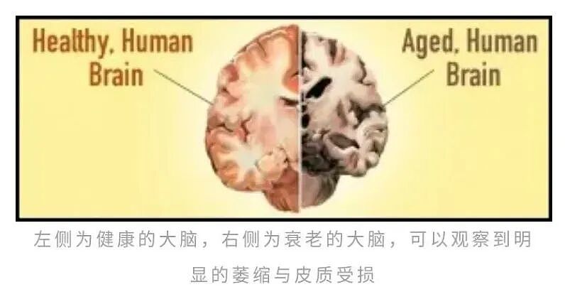 剑桥研究揭示大脑四次重启：9岁前鸡娃是白费力气（组图） - 16