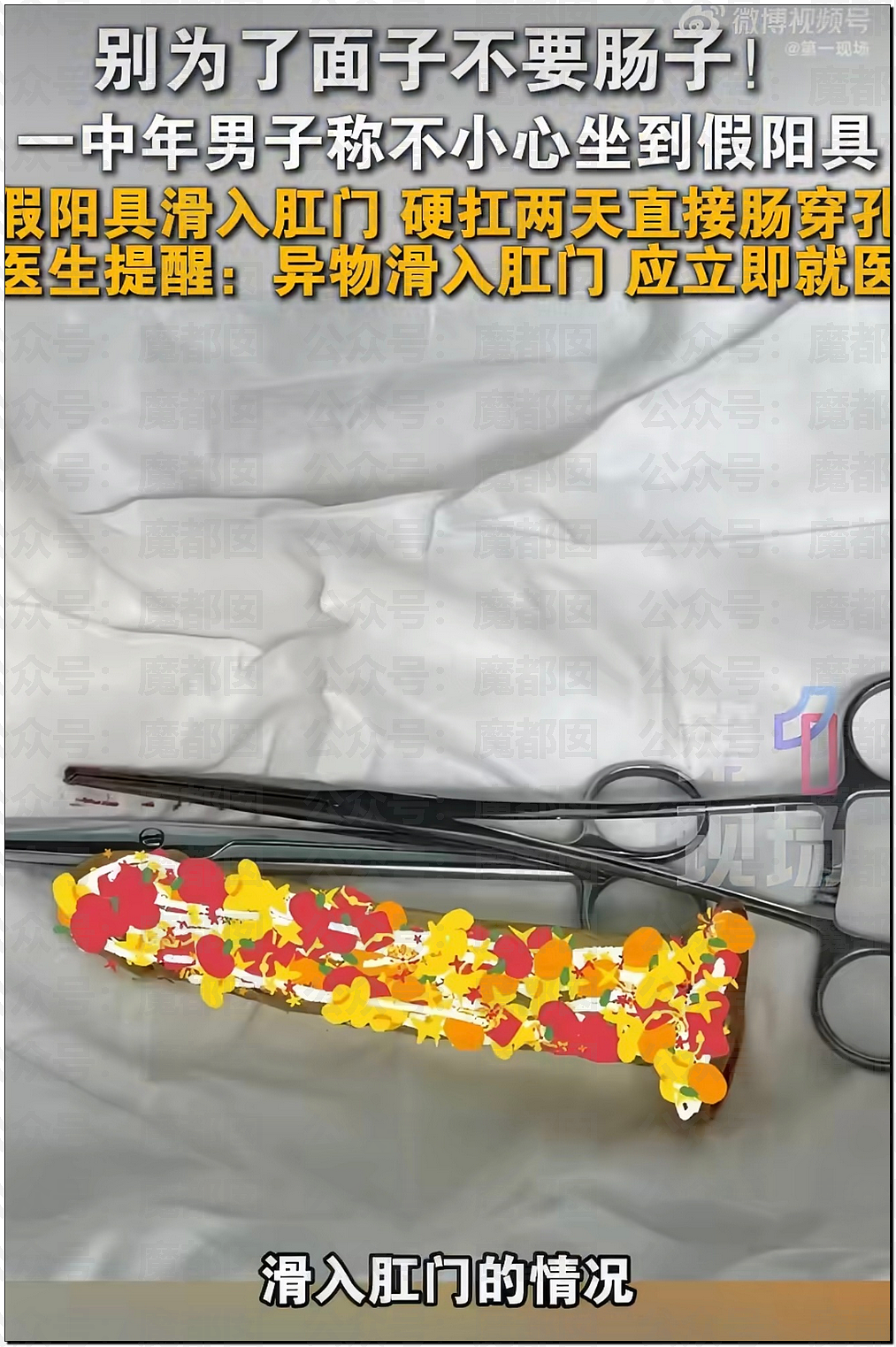 14岁男孩网购假YJ塞GM后整体滑入拿不出来!青少年X教育热议 - 36
