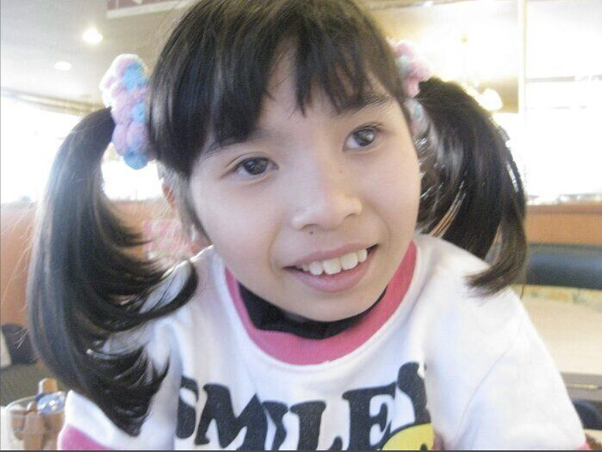 日本妈妈连生两个女儿均患怪病,以正常人5倍速度衰老!19岁体重仅8.5公斤(组图) - 4