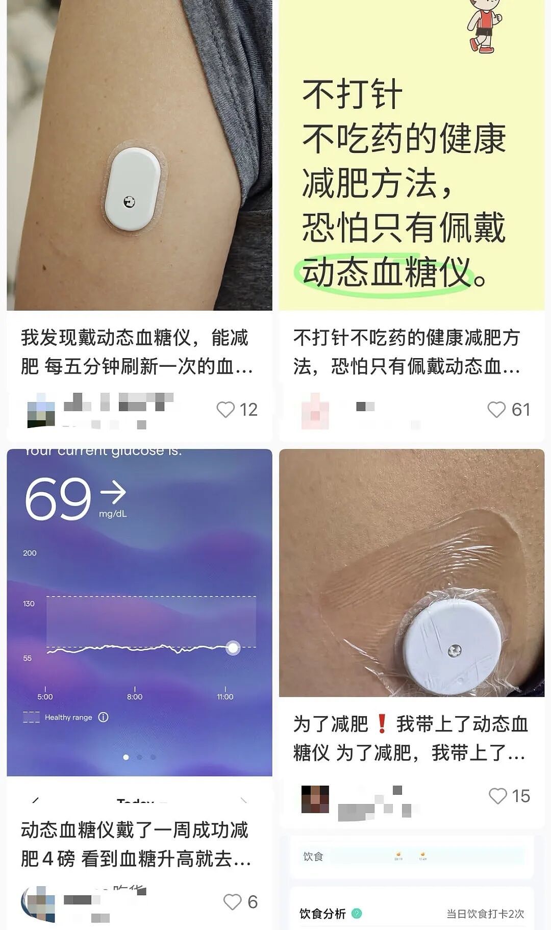 中产最新“电子镣铐”：动态血糖仪（组图） - 2