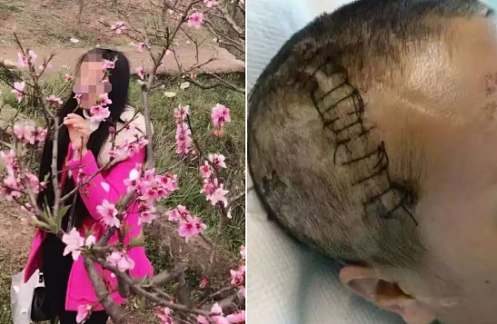 照顾植物人女友2年的深情网红,一直没说过,人是他摔的…(组图) - 9