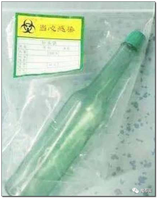 14岁男孩网购假YJ塞GM后整体滑入拿不出来!青少年X教育热议 - 67