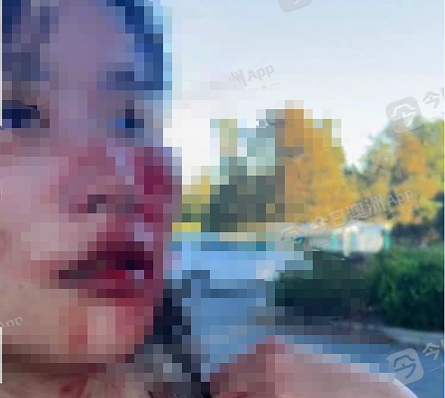 愤怒！澳洲华女遇种歧辱骂，被暴打至浑身是血，由救护车送院！悍妇更持刀威胁，一走了之 - 1
