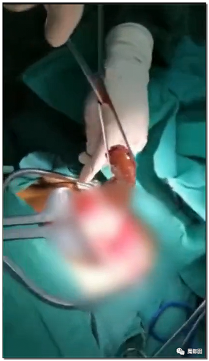 14岁男孩网购假YJ塞GM后整体滑入拿不出来!青少年X教育热议 - 45