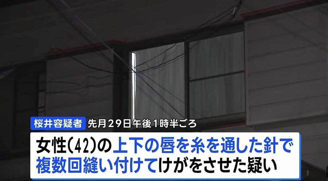 日本49岁女子虐待同居女性,将其嘴巴用针线缝死!被害女子举纸条求救! - 1