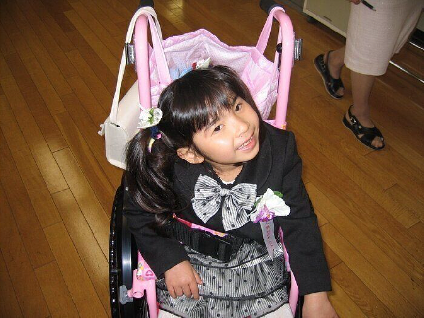 日本妈妈连生两个女儿均患怪病,以正常人5倍速度衰老!19岁体重仅8.5公斤(组图) - 5
