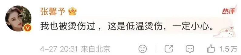 杨幂晒照,脸被烫伤!张馨予留言:我也被烫过 - 3