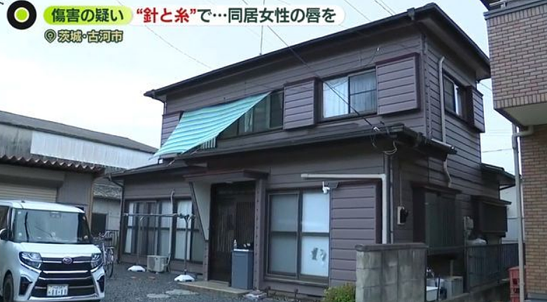 日本49岁女子虐待同居女性,将其嘴巴用针线缝死!被害女子举纸条求救! - 5