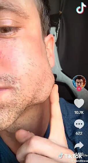 前途无量的腹肌小哥,自己疯了!往自己体内注射液态黄金,觉得能获得超能力??啥? - 8