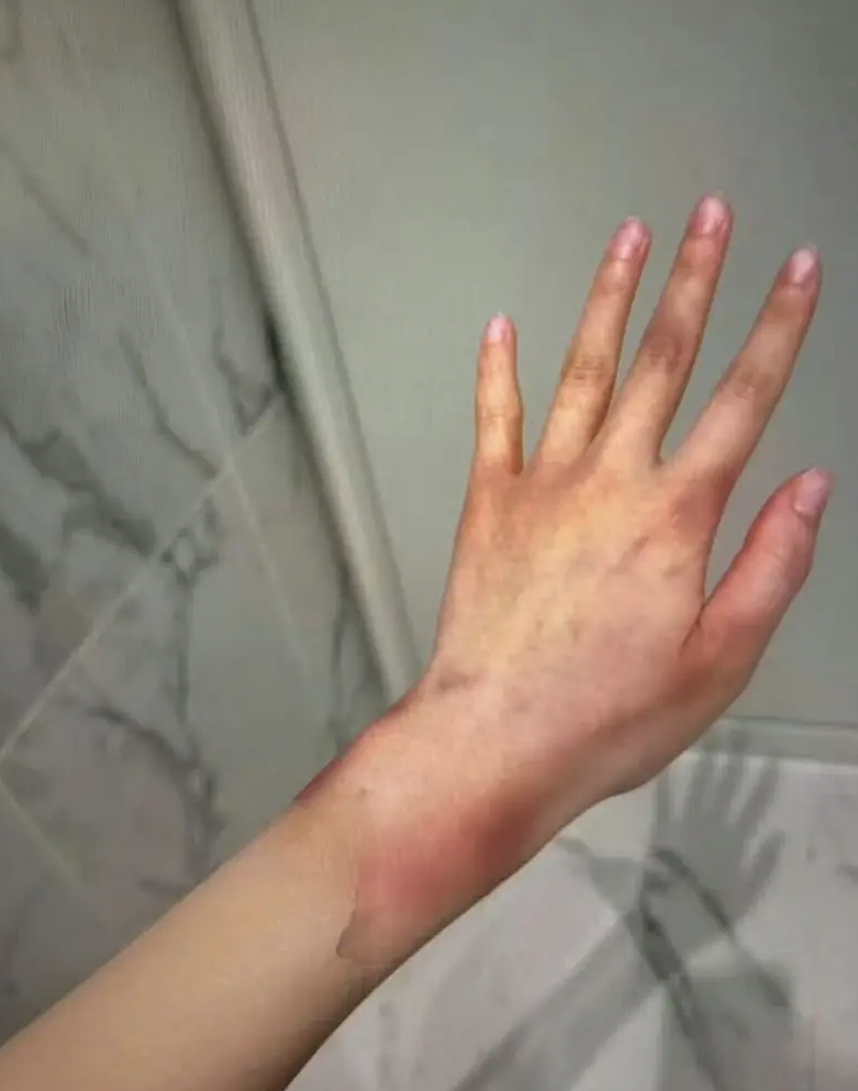 恐怖虐待、性侵，身体被打到“没一处好”；BLACKPINK女星也不能忍了（组图） - 6