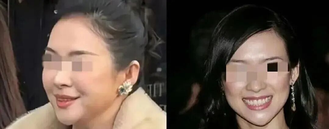 “王祖贤医美”冲上热搜！网友在硅谷偶遇王祖贤，眼部状态变化引发网友猜测（组图） - 5