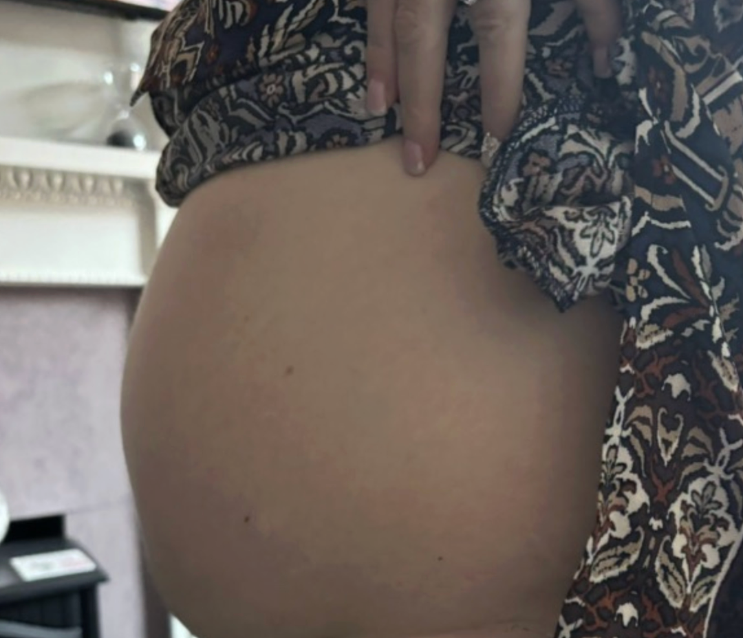 肚子隆起,朋友们恭喜她怀孕,泡澡时“宝宝”却在浴缸里破裂,差点命都没了 - 2