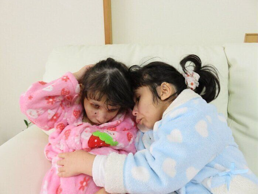日本妈妈连生两个女儿均患怪病,以正常人5倍速度衰老!19岁体重仅8.5公斤(组图) - 6