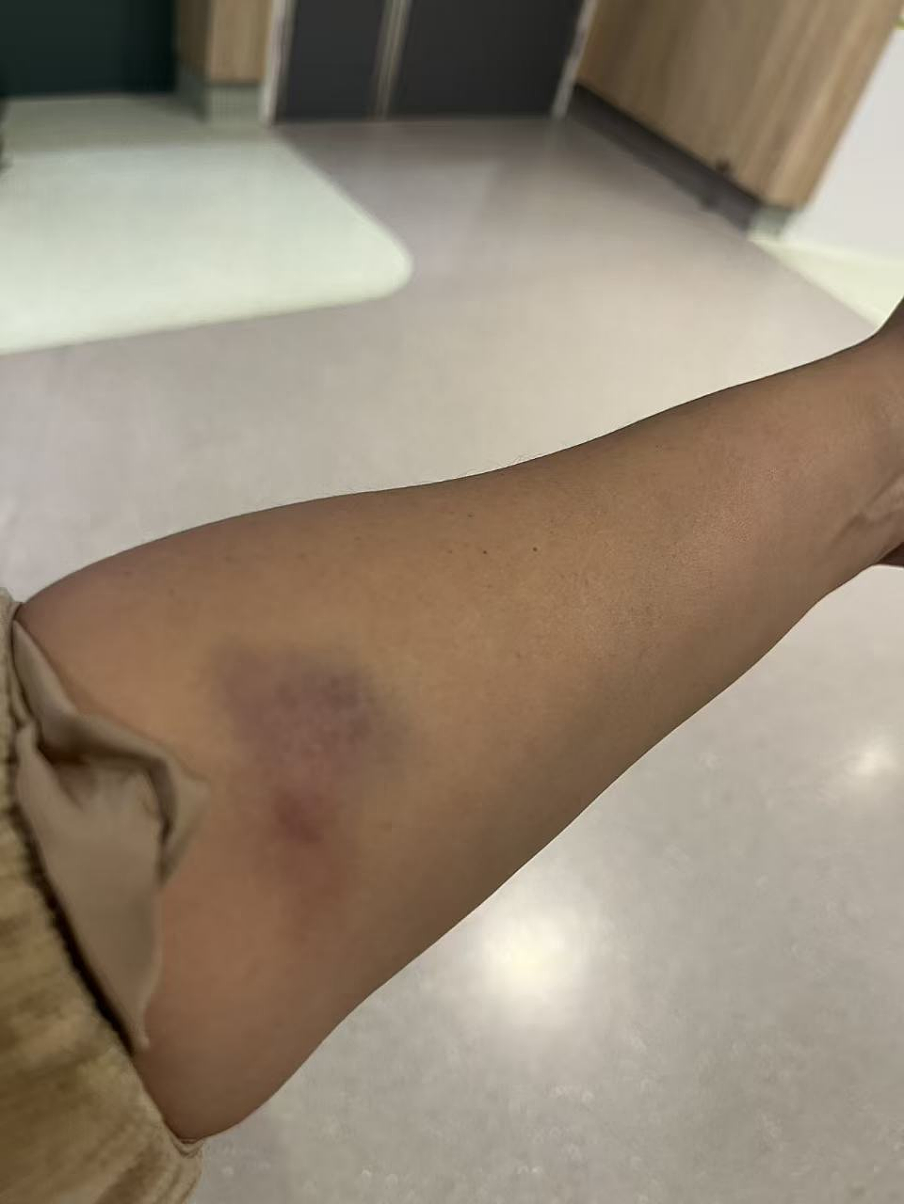 后脑着地,人被击打,拖行!澳华女教师:我是受害者,警方却在深夜上门施压(组图) - 4