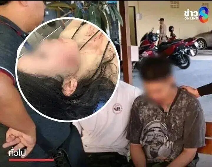 惨烈！中国女游客泰国中弹：子弹穿脸而过，打掉多颗牙齿卡在舌头上（组图） - 1