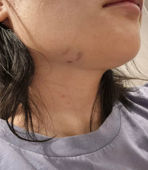 澳华女遭小孩歧视辱骂，街头被暴打，有人竟当场掏出长刀（组图） - 5