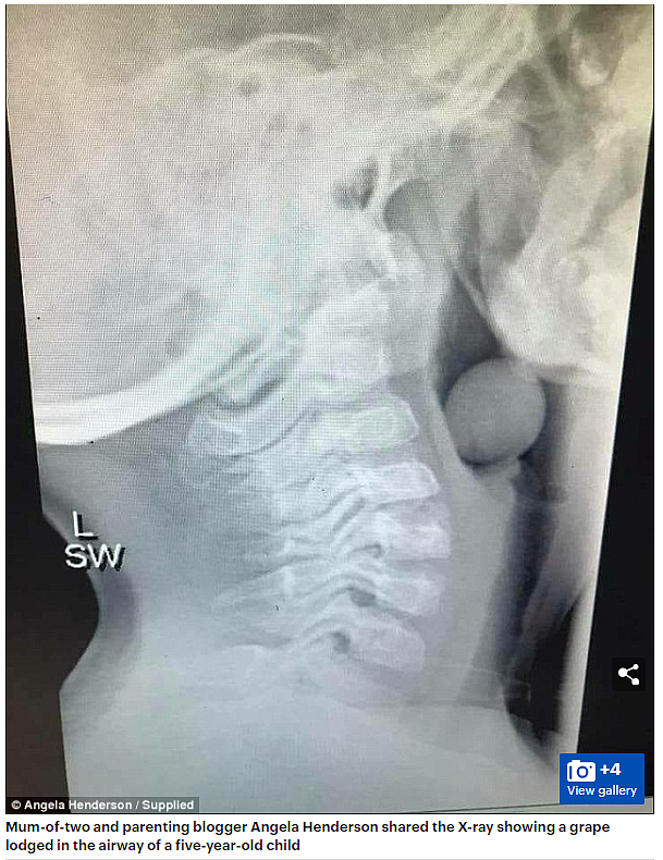 关乎生死！澳洲医护妈妈支招，绝不能往孩子的午餐盒里放这5类食物（组图） - 11