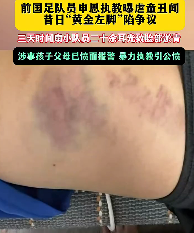 中国前国脚掌掴小球员,家长报警!上海足协通报:申思2013年已被“禁足”(组图) - 2
