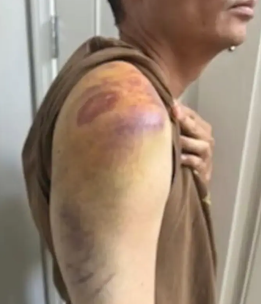 美国华裔探员遭便衣警察锁喉暴打+种族辱骂，险进冤狱...（组图） - 2