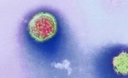 死亡率超新冠!豪华邮轮暴发罕见“人传人”病毒,3人死亡!已蔓延至欧洲多国 - 8