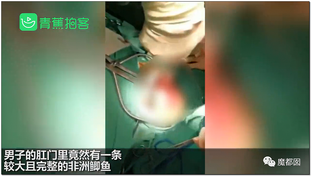 14岁男孩网购假YJ塞GM后整体滑入拿不出来!青少年X教育热议 - 40