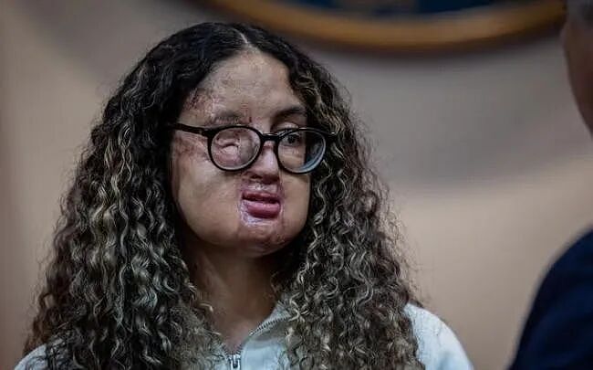 妹子街头惨遭泼硫酸,但凶手根本不认识,抓不到!结果几年后,凶手自己写歌自曝了... - 4